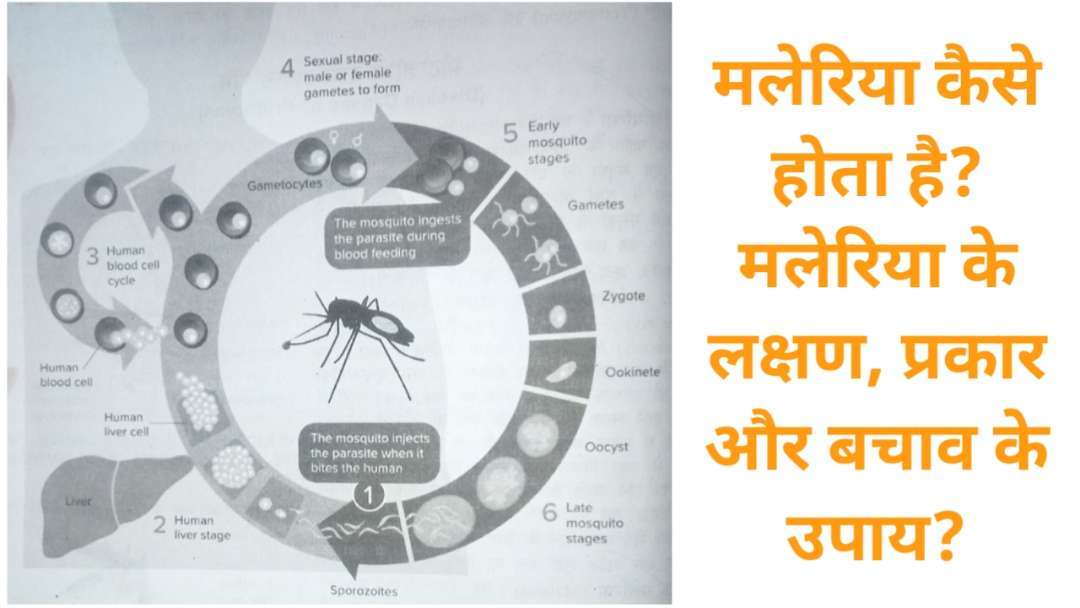 मलेरिया कैसे होता है? मलेरिया के लक्षण, प्रकार और बचाव के उपाय