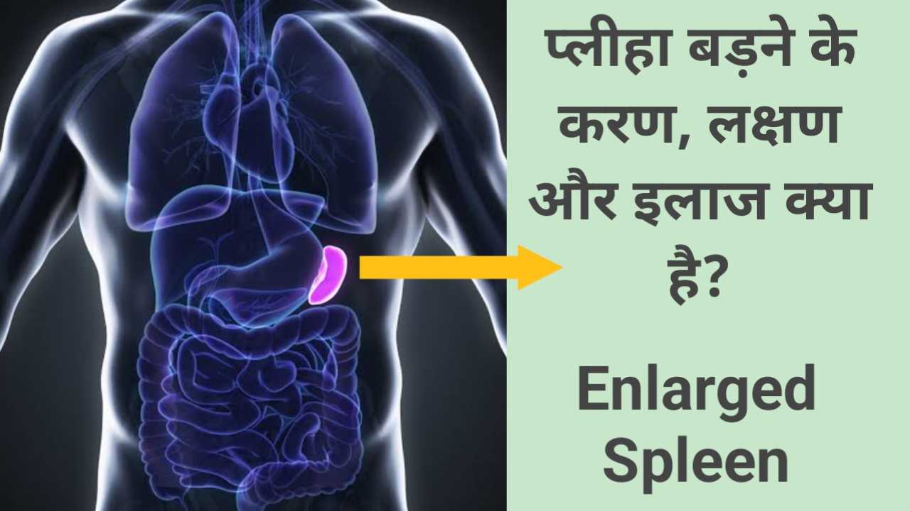 Enlarged spleen causes, symptoms and treatment