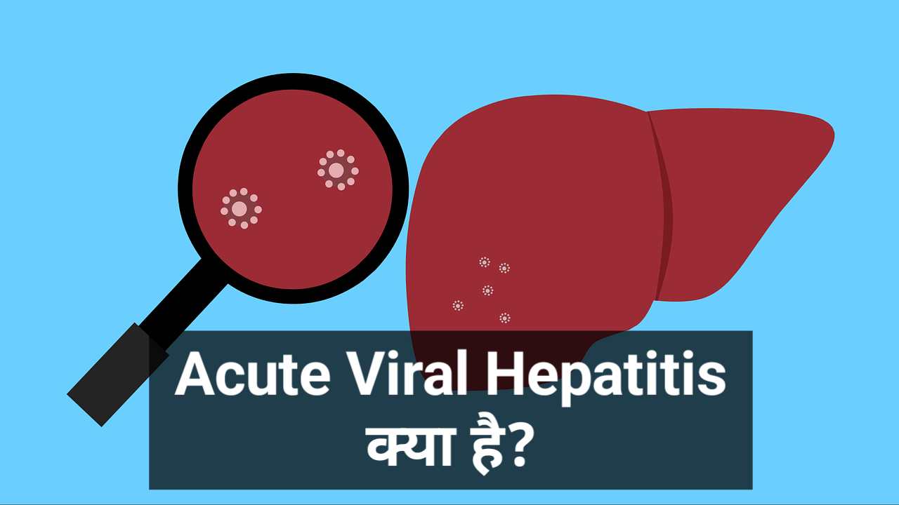 Acute Viral Hepatitis 