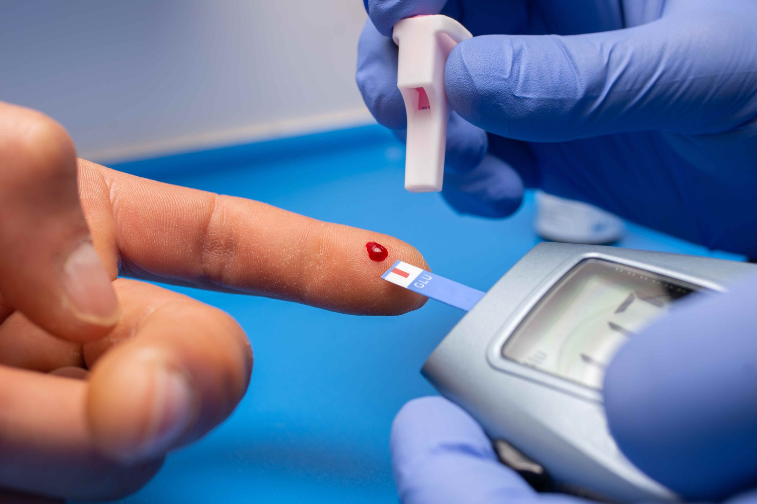 blood glucose test scaled