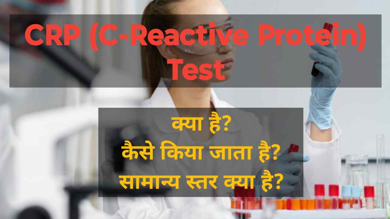 CRP Test in Hindi